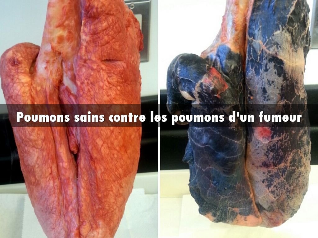 Le traitement avec tabeks