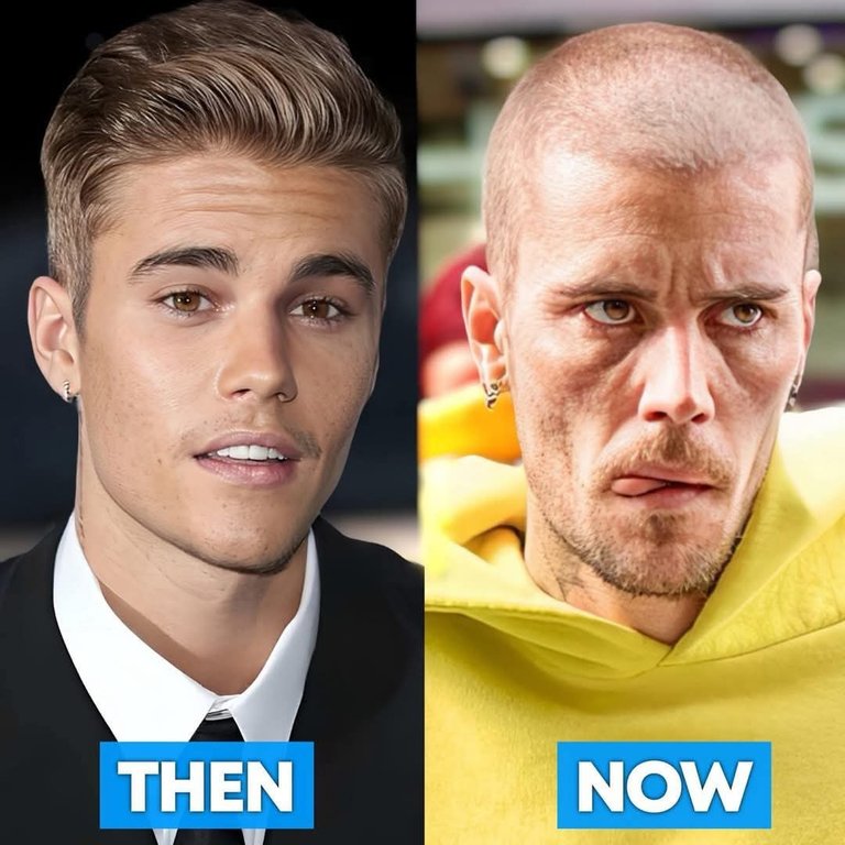 La drogue a ravagé Justin Bieber