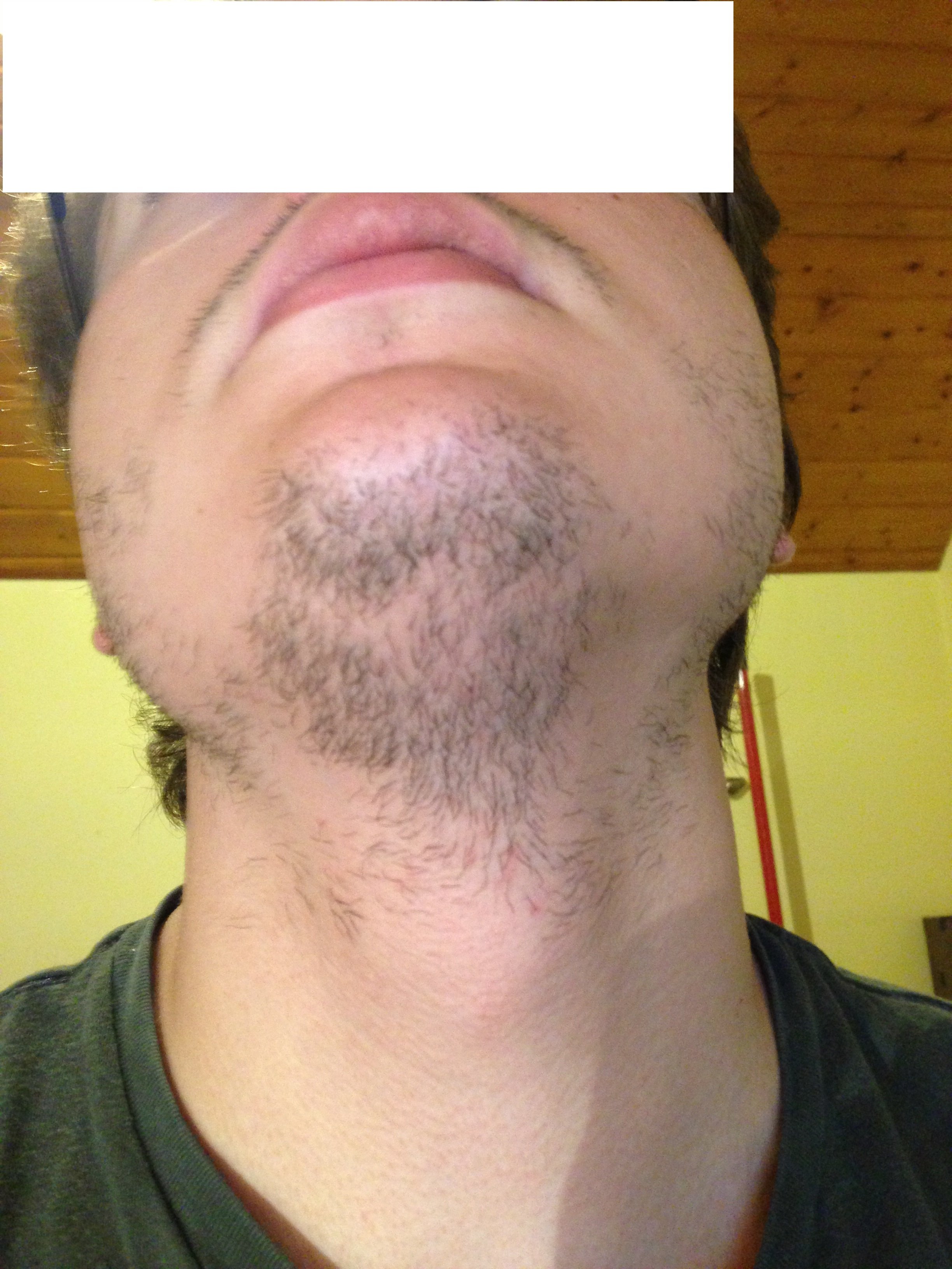 Photo] Ma barbe de puceau. sur le forum Blabla 18-25 ans - 24-06-2013  22:41:04 - jeuxvideo.com