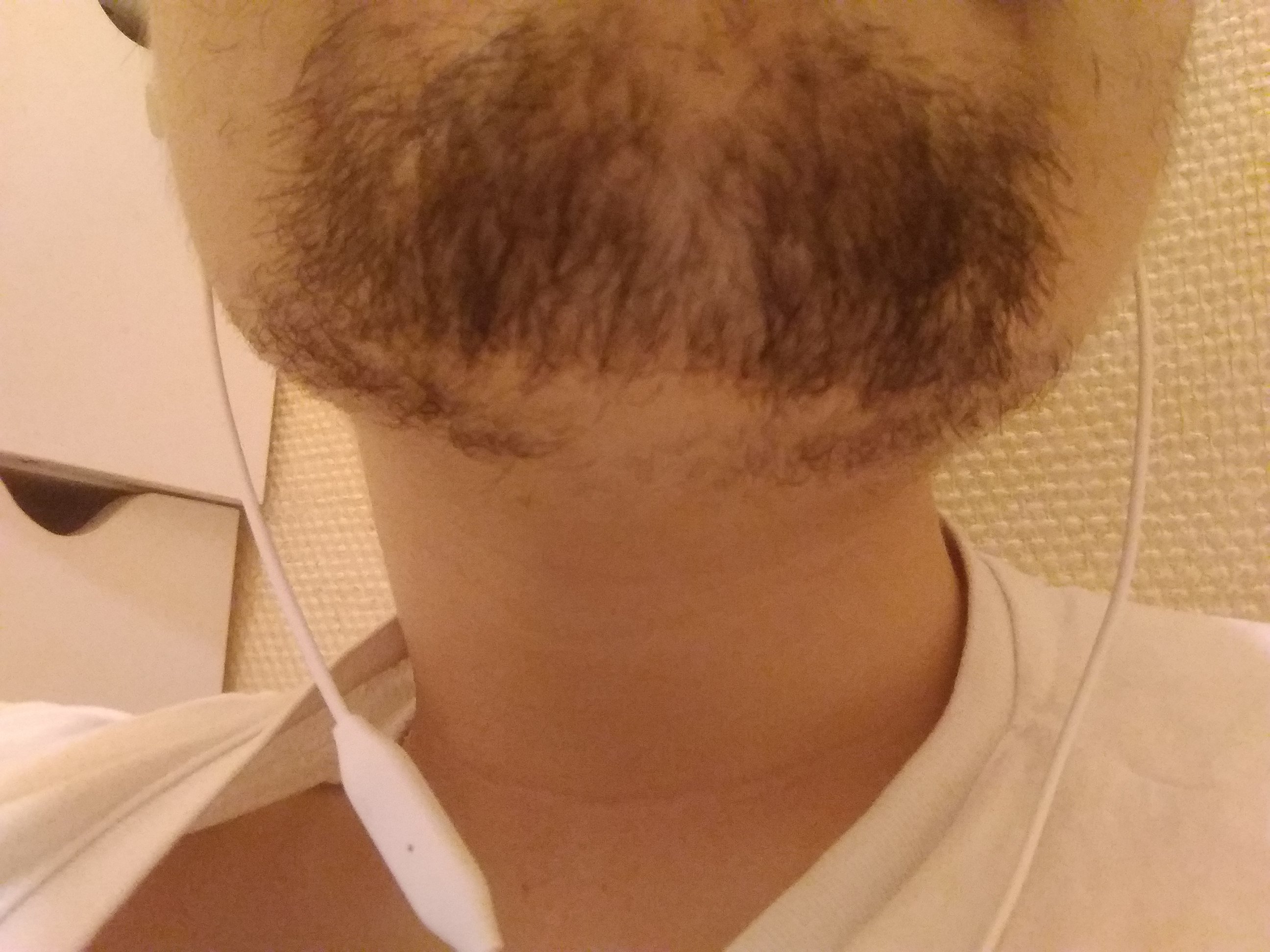 Problème de barbe sur le forum Blabla 18-25 ans - 17-02-2018 03:53 ...