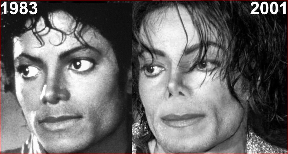 Michael Jackson N A Rien Refait D Autre Que Son Nez Sur Le Forum Blabla 18 25 Ans 12 08 2018 16 56 44 Jeuxvideo Com