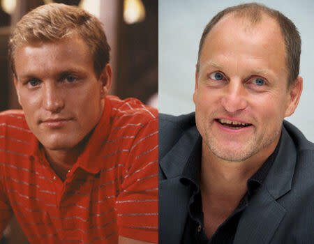 L'acteur Woody Harrelson avant/après CALVITIE sur le forum Blabla 18-25 ...