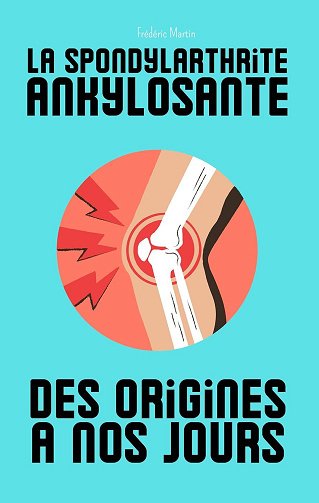 Frédéric Martin - La spondylarthrite ankylosante, des origines à nos jours (2024)