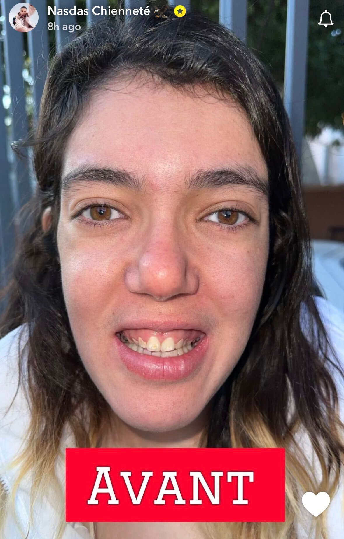 Assya qui passe de 2/10 a 8/10