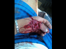 https://image.noelshack.com/fichiers/2012/21/1337948437-Accident1.jpg