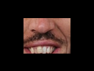 https://image.noelshack.com/fichiers/2012/25/1340283087-b3959db6a2b6945b4785de25017550ef.png