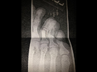 https://image.noelshack.com/fichiers/2012/48/1354297135-photo-double-fracture-du-pied-pour-mathew-bellamy-50b887763b09f.jpg