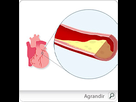 https://image.noelshack.com/fichiers/2013/02/1357739980-hypercholesterolemie-pm-1.jpg