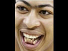 https://www.noelshack.com/2013-11-1363259702-anthony-davis-heinous-teeth.jpg