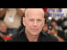 https://image.noelshack.com/fichiers/2013/16/1366044061-chauve1.jpg