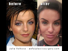 https://image.noelshack.com/fichiers/2013/20/1368836213-julia-volkova-plastic-surgery-before-and-after.jpg