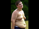 https://image.noelshack.com/fichiers/2013/27/1372799156-flickr-obese-jeune13-14ans.jpg