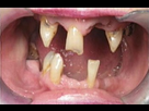 https://image.noelshack.com/fichiers/2013/46/1384552947-189789-837562202-meth-mouth-h190345-l.jpg