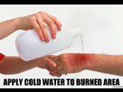 https://image.noelshack.com/fichiers/2014/02/1389534083-apply-cold-water-to-the-burned-area.jpeg
