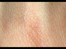 https://image.noelshack.com/fichiers/2014/14/1396443368-human-skin-structure.jpg