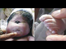 Naissance D Un Bebe Cyclope En Inde Sur Le Forum Philosophie 22 08 14 06 36 54 Jeuxvideo Com