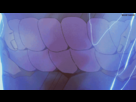 https://image.noelshack.com/fichiers/2014/35/1409086029-tumblr-m70pfnu7kj1r4h3tzo1-500.gif