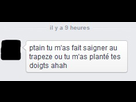 https://image.noelshack.com/fichiers/2014/50/1418209193-brachcoachdefolie.jpg