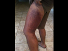 https://image.noelshack.com/fichiers/2015/08/1424182709-urijah-faber-leg-3.jpg
