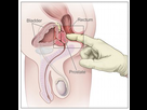 https://image.noelshack.com/fichiers/2015/23/1433693663-prostate-dre.jpg