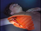 https://image.noelshack.com/fichiers/2015/24/1434038701-paralysie-du-nerf-thoracique-ou-nerf-de-charles-bell-93513986.jpg