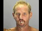 https://image.noelshack.com/fichiers/2015/26/1435149727-the-man-with-three-teeth-ugly-man-with-bad-teeth.jpg