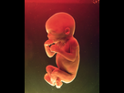 https://image.noelshack.com/fichiers/2015/50/1450021766-foetus-62521-3710341.jpg