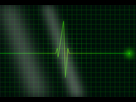 https://image.noelshack.com/fichiers/2016/16/1461535157-electrocardiogram.jpg