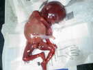 https://image.noelshack.com/fichiers/2016/23/1465404572-foetus1.jpg