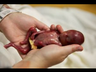 https://image.noelshack.com/fichiers/2016/23/1465404578-foetus2.jpg