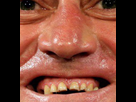 https://image.noelshack.com/fichiers/2016/28/1468218416-dvgbrhntyhrgdf.png