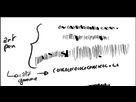 https://image.noelshack.com/fichiers/2016/32/1471033308-3e3718b87d61fed7bd422dbbad0d9b3b.png
