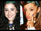 https://image.noelshack.com/fichiers/2016/37/1473727914-ariana-grande-before-and-after-plastic-surgery-05.jpg