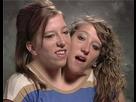 https://image.noelshack.com/fichiers/2016/44/1478279752-video-abby-et-brittany-liees-pour-la-vie-sur-nt1-news-full2.png