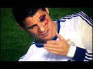 https://www.noelshack.com/2017-26-6-1498936026-cristiano-ronaldo-588-injury-bleeding-from-his-eye-and-left-eyebrow-after-being-elbowed-in-levante-vs-real-madrid-for-la-liga-2012-2013.jpg