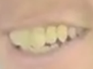 https://image.noelshack.com/fichiers/2017/44/6/1509825584-design-alexandre-tooth.png