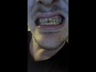 https://image.noelshack.com/minis/2017/45/5/1510344666-mesdents.png