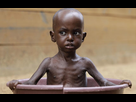 https://image.noelshack.com/minis/2017/47/3/1511322272-somalie-famine-enfant-1.png