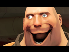 https://image.noelshack.com/minis/2017/47/4/1511431559-1505421654-lol.png