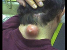 https://image.noelshack.com/minis/2017/47/6/1511607203-2683-huge-zit.png