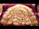 https://image.noelshack.com/minis/2017/48/1/1511790631-bouche-remplie-dents.png