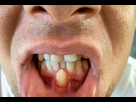 https://image.noelshack.com/minis/2017/48/1/1511790638-hyperdontia-948x640.png