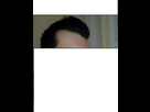 https://image.noelshack.com/minis/2017/49/2/1512447113-vegetacalvitie.png