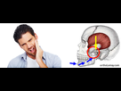 https://image.noelshack.com/minis/2017/49/4/1512619634-trauma-menton-articulation-tmj-atm-tmd-orthodontie-sherbrooke-orthodontiste.png