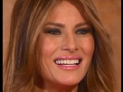 https://image.noelshack.com/fichiers/2017/49/4/1512685298-melania-4.png