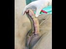 https://image.noelshack.com/minis/2017/49/7/1512935762-total-phalloplasty-stage-two-urethroplasty-lg-m1220058.png