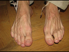 https://image.noelshack.com/minis/2017/50/7/1513473427-pieds-d-homme.png