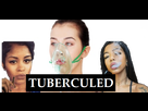 https://image.noelshack.com/minis/2018/02/6/1515884167-tuberculed3.png