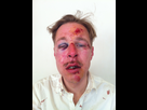 https://image.noelshack.com/minis/2018/05/6/1517651973-wilfred-de-bruijn-wounded-same-sex-marriage-in-france.png