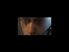 https://image.noelshack.com/fichiers/2018/08/2/1519165801-zoom-sur-doc-face-de-zamel.png